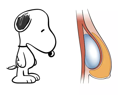 Snoopy Dog Deformity Snoopy Dog Deformity