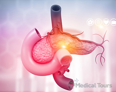 Causes of Pancreatic Cancer