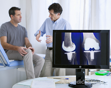 Condition Required for Knee Replacement Surgery