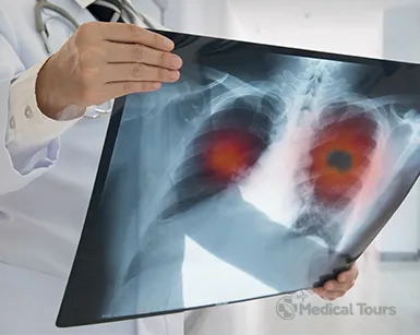 Diagnosis of Lung Cancer