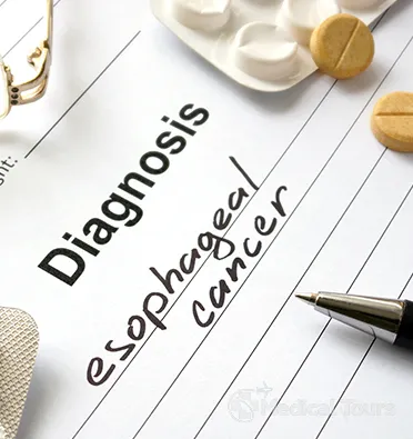 Diagnosis of Esophageal Cancer Diagnosis of Esophageal Cancer