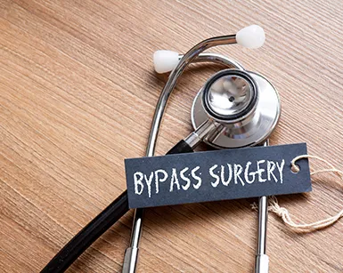 (CABG) Heart Bypass Surgery (CABG) Heart Bypass Surgery