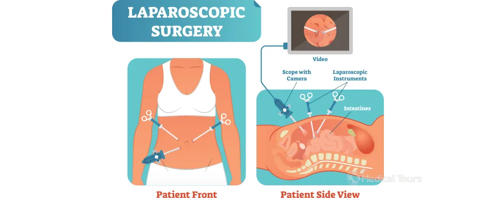 Treatment Options for Shoulder Replacement Surgery Treatment Options for Shoulder Replacement Surgery
