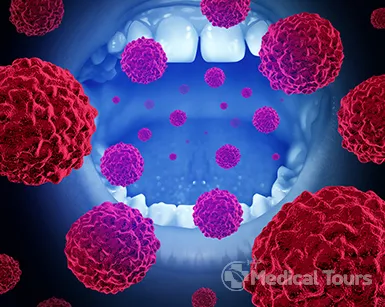 Oral Cancer