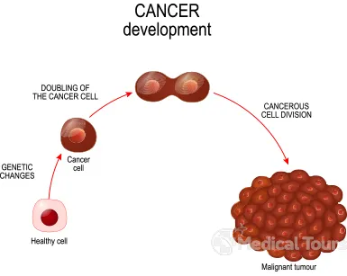 Cancer Development in Body