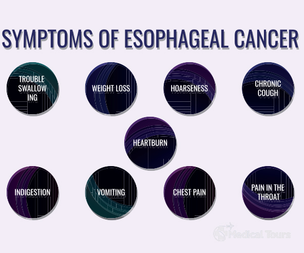 Symptoms of Esophageal Cancer
