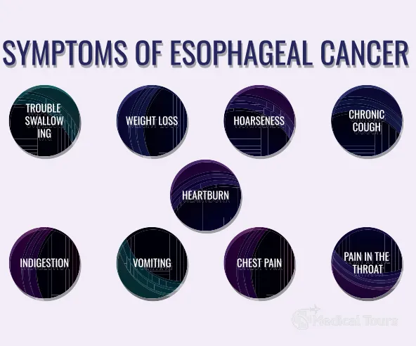 Symptoms of Esophageal Cancer Symptoms of Esophageal Cancer