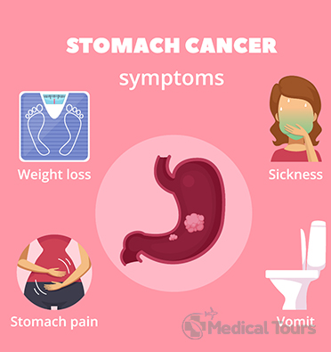 Stomach/Gastric Cancer Symptoms