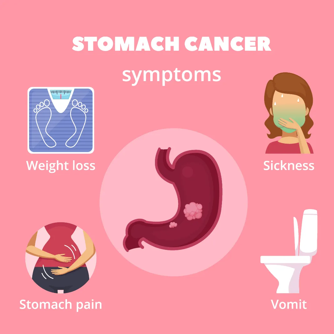 Stomach/Gastric Cancer Symptoms