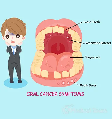 Symptoms of Oral Cancer