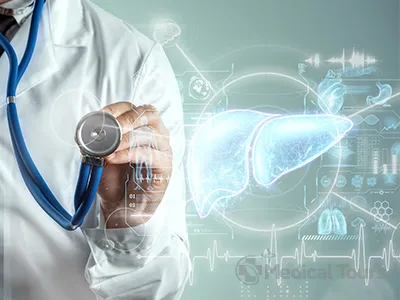 Treatment Options for Liver Cancer