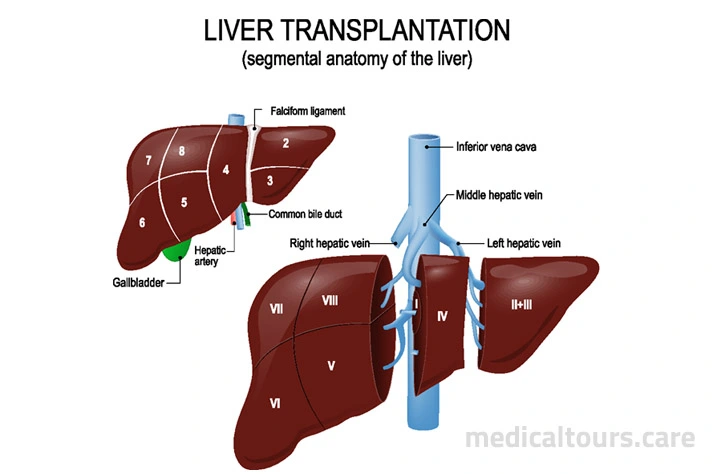 Liver Transplantation