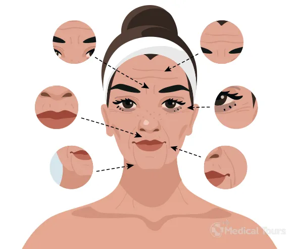 Neck Cancer Neck Cancer